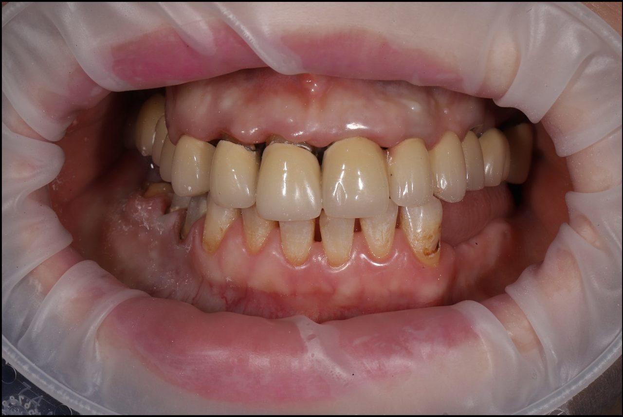 Before treatment